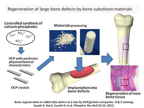  Osteoconductive Hydroxyapatite : Un Champion de la Régénération Osseuse !